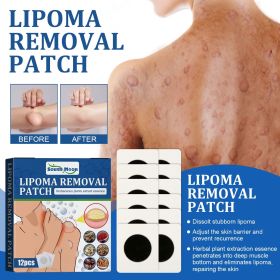 South Moon Lipoma Removal Patch, Soothing Various Body Fat Knots To Remove Subcutaneous Lumps Care Patch