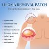 South Moon Lipoma Removal Patch, Soothing Various Body Fat Knots To Remove Subcutaneous Lumps Care Patch